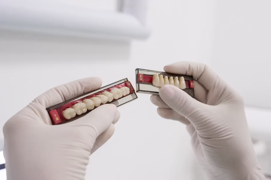 Cura dell'impianto dentale — Studio Dentistico Dr. Frozzi