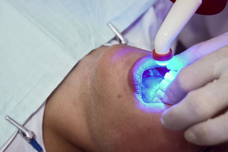 Sbiancamento denti professionale in studio — Studio Dentistico Dr. Frozzi